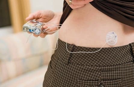 When to reveal your insulin pump