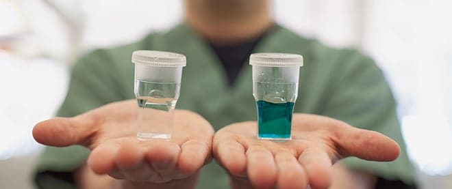 Painless gum disease testing