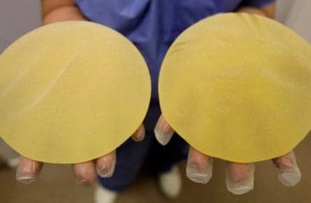 French breast implants: a Science-ish saga?