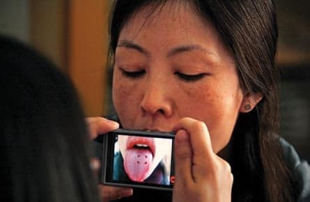Traditional Chinese medicine tongue diagnosis gains favour