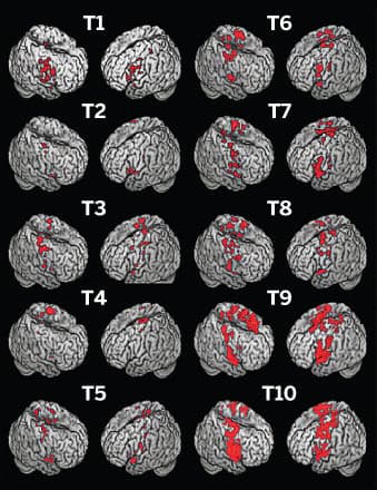 Beyond the EEG: Life after 'flat line'
