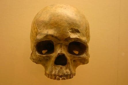 The downsides of human evolution