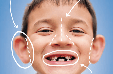 Plastic surgery: Where do parents draw the line?
