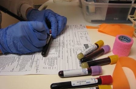 How does Canada's clinical trials database measure up?