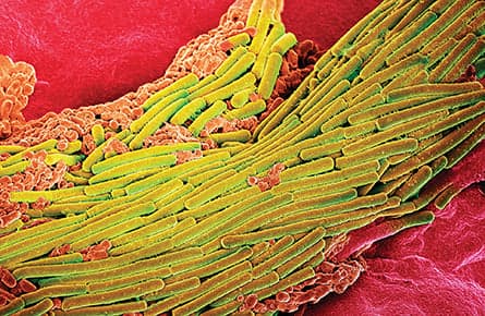 A miracle cure, not for the squeamish