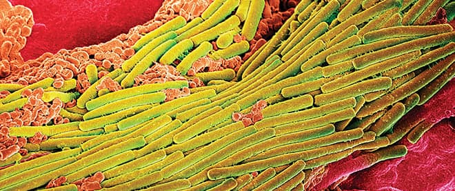 Gut of the matter