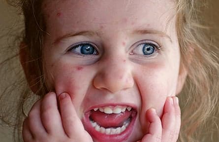 Why do we itch?