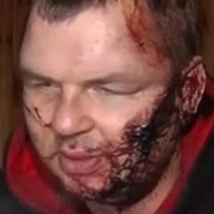 Ukraine activist tells story of ambush and captivity