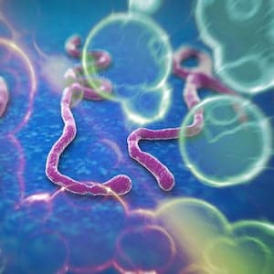 Ebola virus: What you need to know