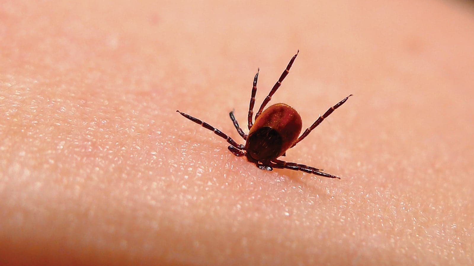 Health Canada's new Lyme disease plan: You act, we'll watch