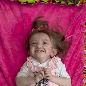 The little girl who may hold the secret to aging