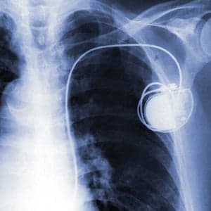 Scientists build a pacemaker from the heart's own cells