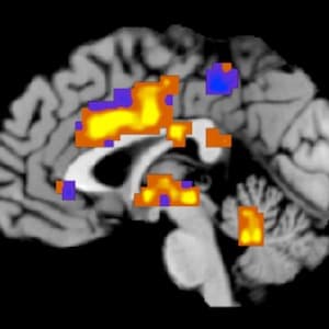 Are we on the cusp of a revolution in how we understand the brain?