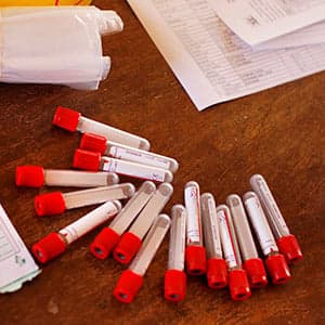 For the record: World AIDS Day