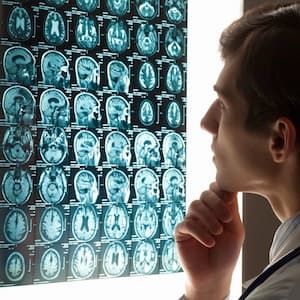 A newfound link between brain injuries and ADHD
