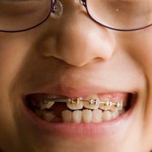 Orthodontics a huge challenge for Northern residents
