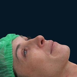 The story of Danica Rain's pioneering gender-confirmation surgery