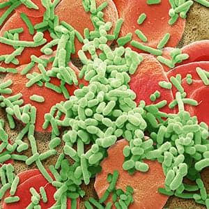 Blood ties: The inspiration behind a potential sepsis breakthrough