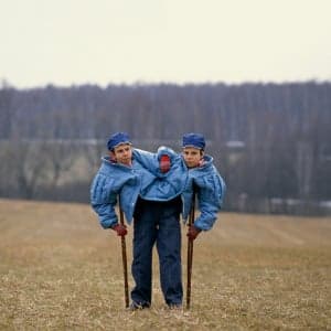 The torture and sadness of Russia's most famous conjoined twins