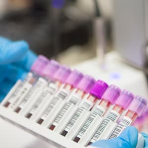 Innovative science research in Canada is dying a silent death