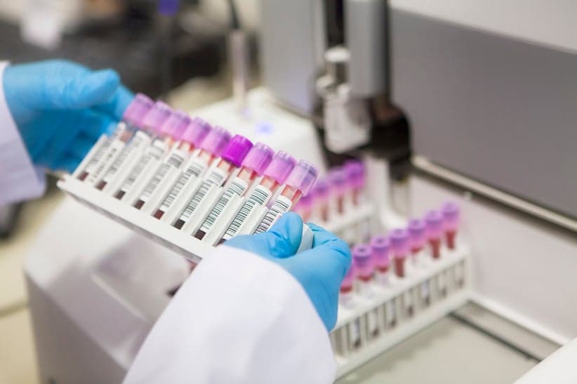 Laboratory Experiment blood test