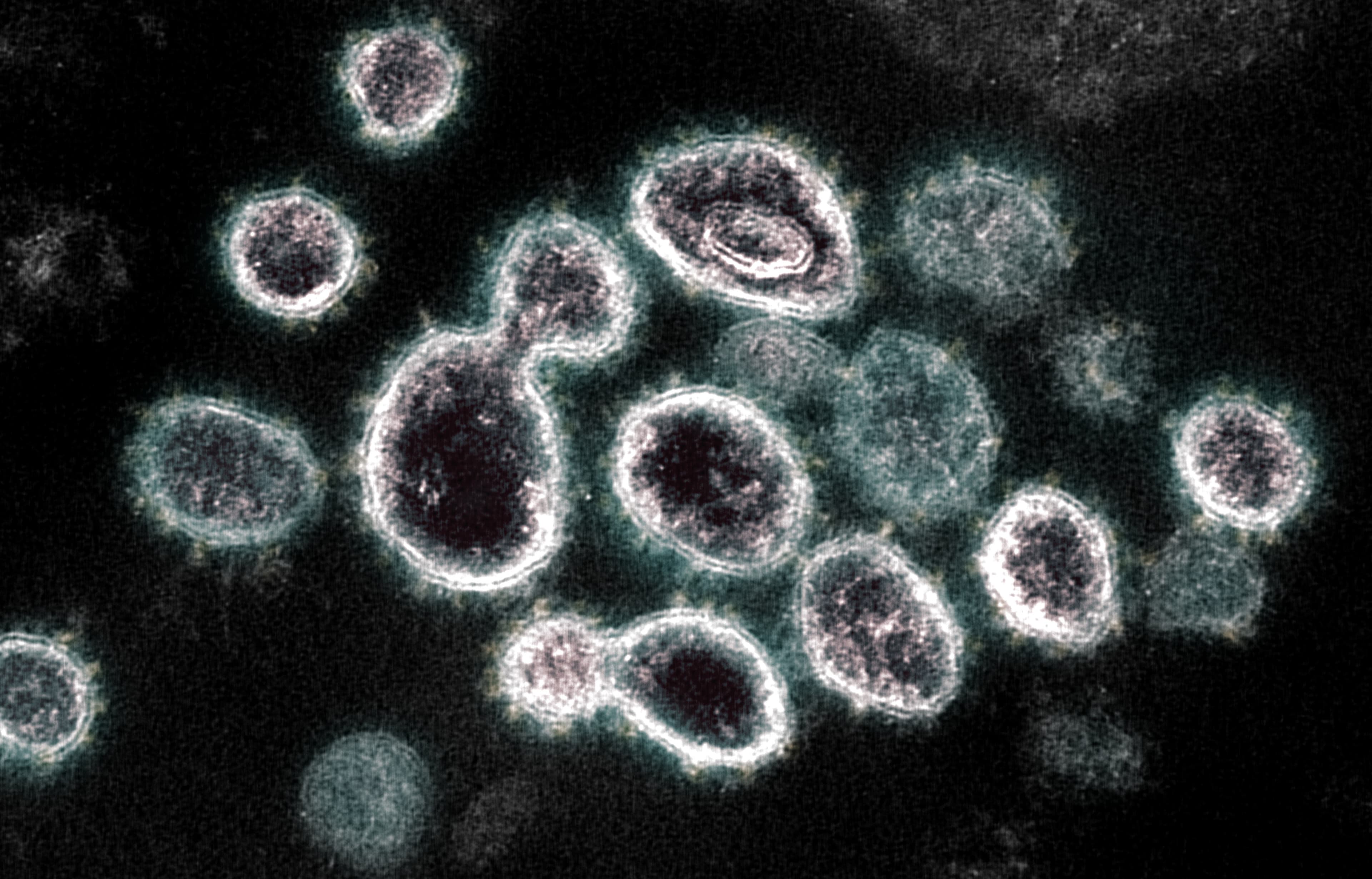 There's a new strain of COVID-19. Will the vaccines work against it?