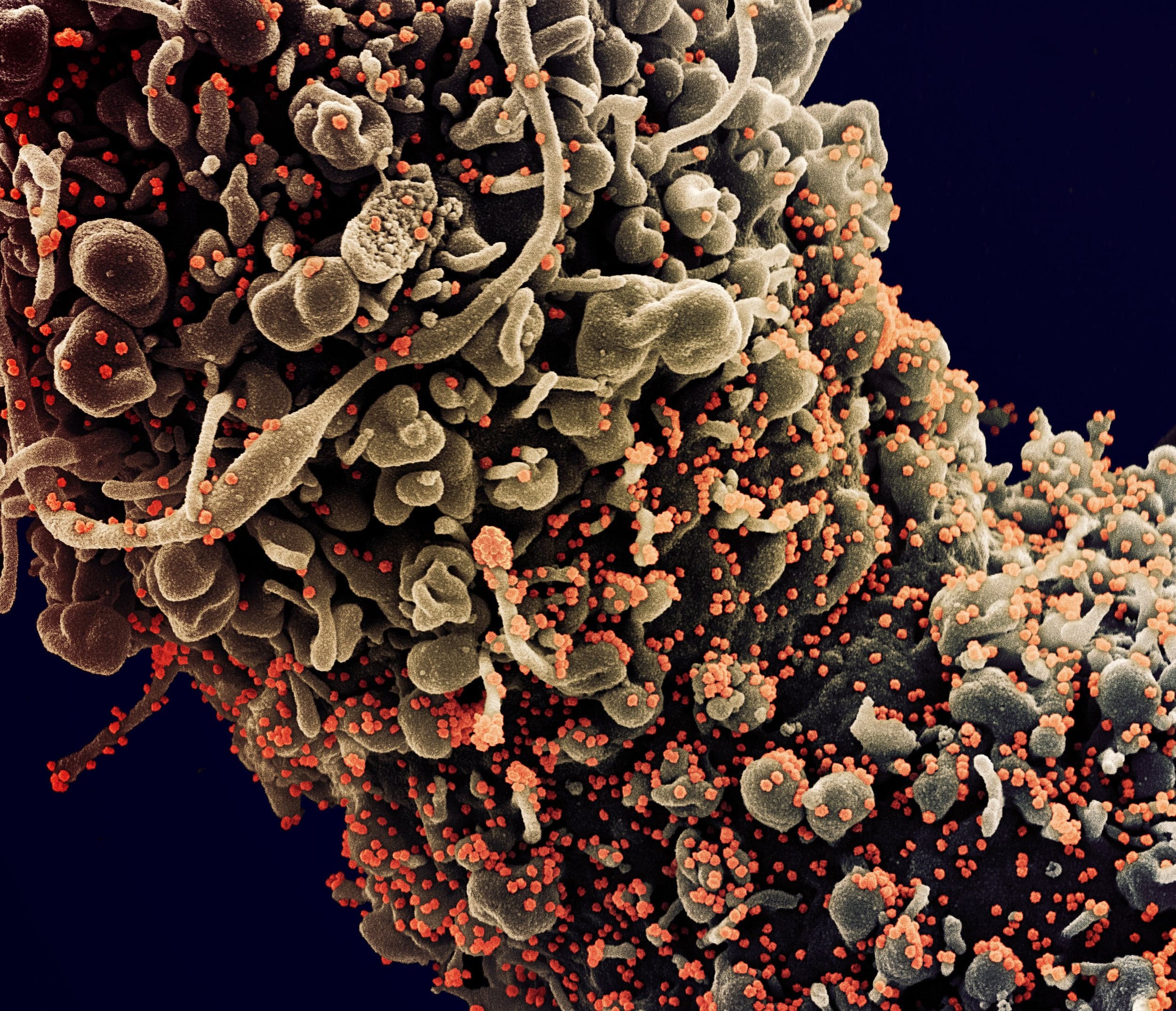 Inside the global race against COVID-19 mutations