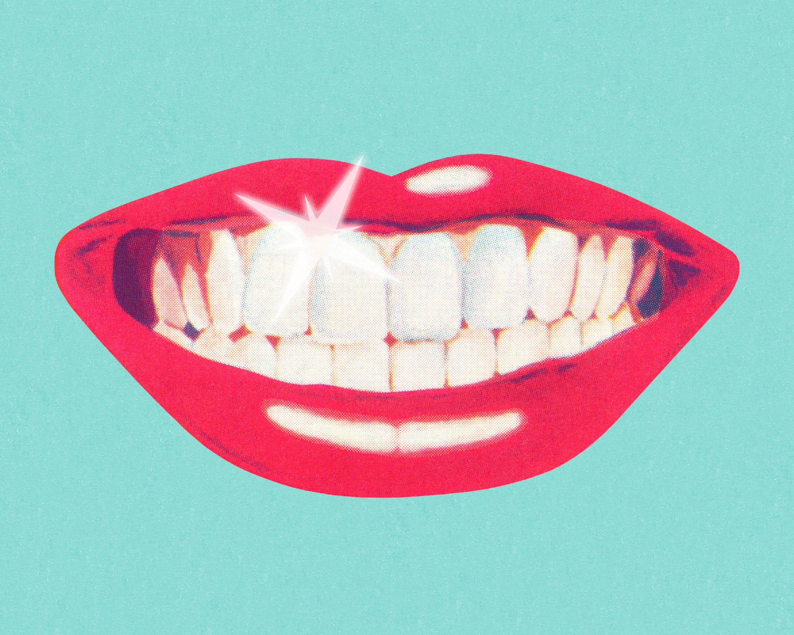 Why Calgary Brought Fluoride Back