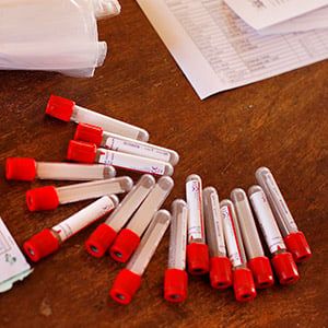 Blood vials for HIV testing