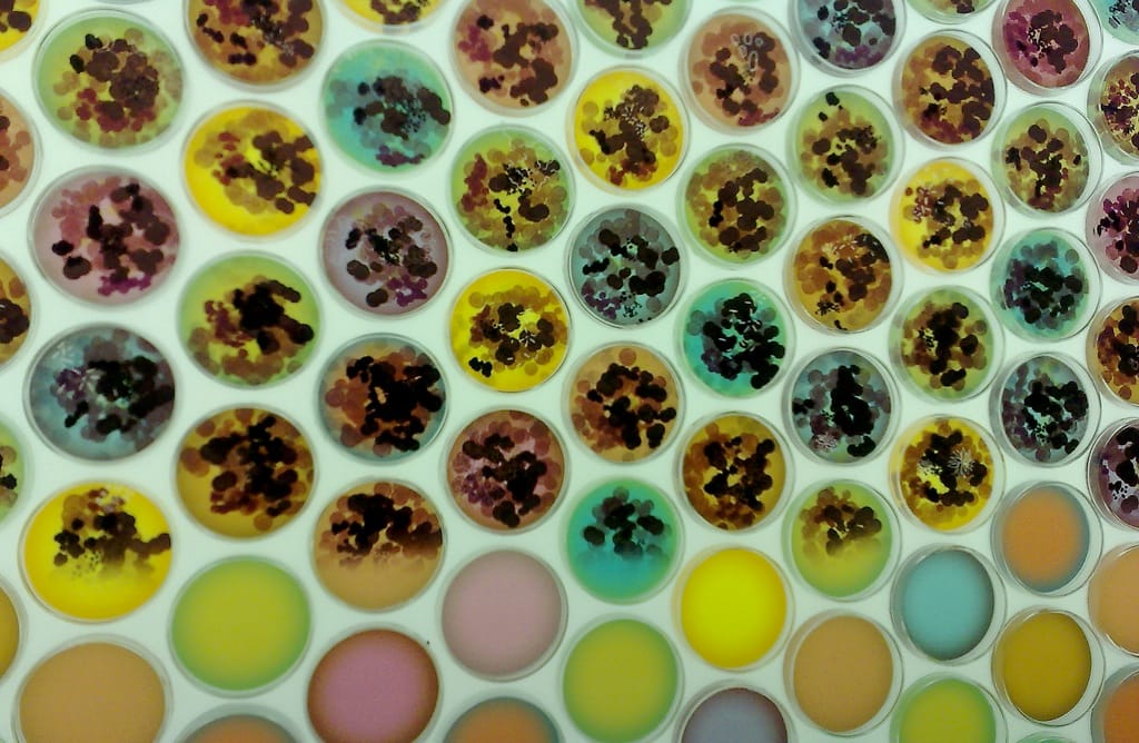 120218_bacteria
