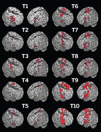 brainscanchart