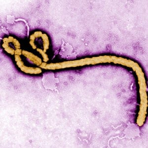 Some of the ultrastructural morphology displayed by an Ebola virus virion is revealed in this undated handout colorized transmission electron micrograph
