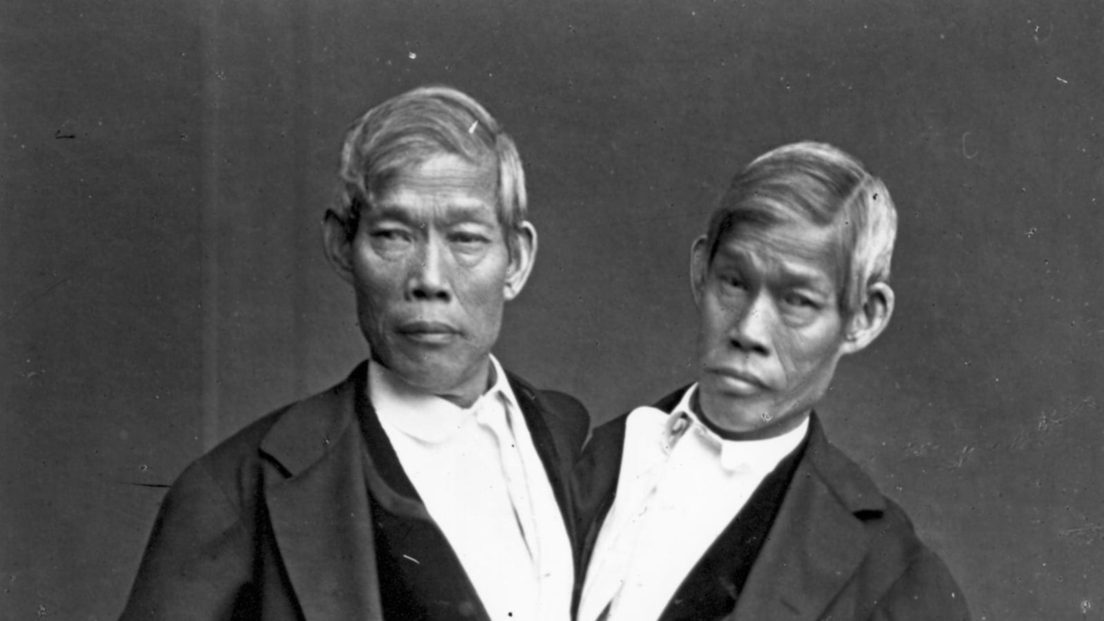 Siamese Twins