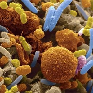 Human feces consist of undigested food residues and a great variety of bacteria. SEM shows a very large proportion of the bacteria and, thus, a high health hazard that the bacteria may contaminate food sources if hygienic rules are not adhered to, particu (Getty Images)