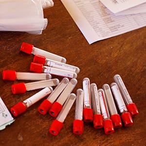 Blood vials for HIV testing (Hoberman Collection/UIG/Getty Images)