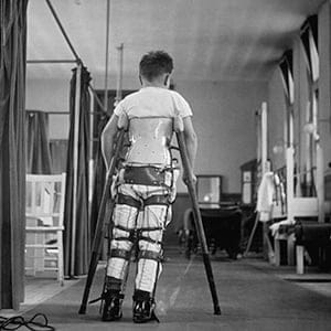 A child suffering from Infantile Paralysis learning to walk with the aid of a special support, at Queen Mary's Hospital, London, 1947.  (George Konig/Keystone Features/Getty Images)