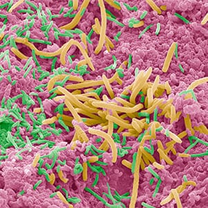 Tongue bacteria. Coloured scanning electron micrograph (SEM) of bacteria on the surface of a human tongue. Large numbers of bacteria can form a visible layer on the surface of the tongue. The mouth contains a large number of bacteria, most of which are harmless or even beneficial. However, some bacteria can cause throat infections or cause the formation of plaque deposits on the teeth, which may lead to decay. (Steve Gschmeissner/Science Photo Library/Getty Images)
