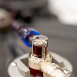 Separation of red blood cells and plasma. After separation the red blood cells are re-injected to the donor.(Photograph by Derek Mortensen)
