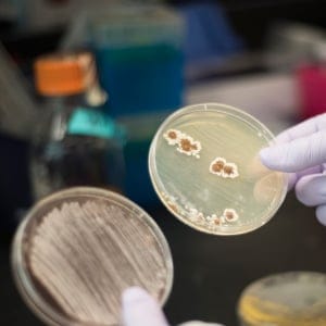 Hayley Zubyk examines streptomyces plates in the Institute for Infectious Disease Research lab at McMaster University in Hamilton, Ontario on Thursday, September 22, 2017. (Photograph by Hannah Yoon)
