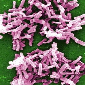 A micrograph image of C. difficile bacteria is shown in a handout photo.The first ever randomized controlled trial of fecal transplants for persistent C. difficile is published. THE CANADIAN PRESS/HO-The U.S. Centers for Disease Control and Prevention, Janice Carr