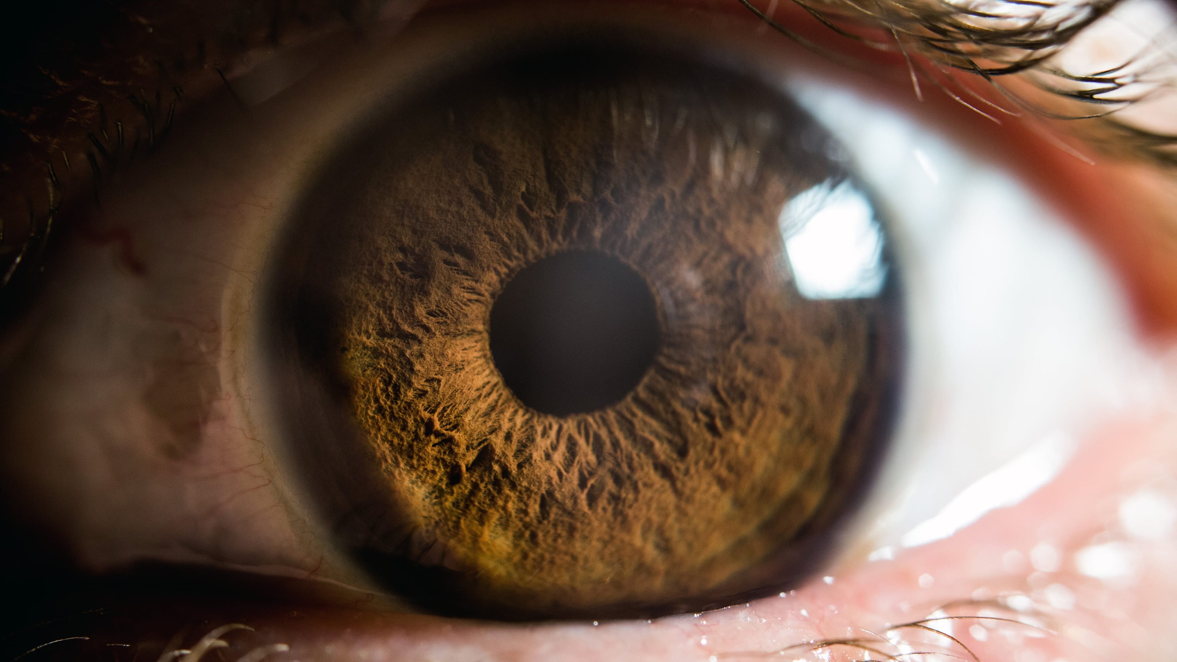 Hallucinogen Persisting Perception Disorder is characterized by a kaleidoscope of visual disturbances, including visual snow or static, intense flashes of colour, false perceptions of movement, geometric hallucinations, afterimages and halos (Adrian Hernandez/iStock)
