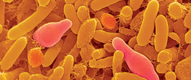 Microscopic miners