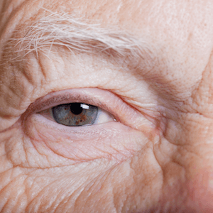 Iris scanners in nursing homes_FEATURE