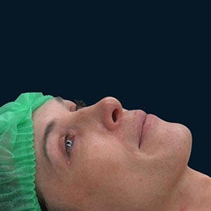Danica lying on the operating table, ahead of her surgery. (Cynthia Mulligan)