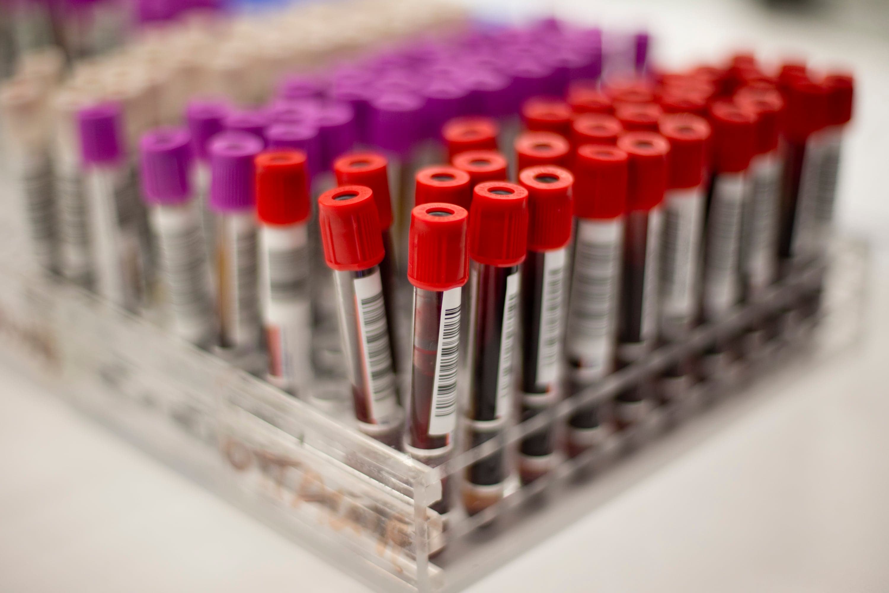 Why we should pay Canadian donors for their blood plasma donations