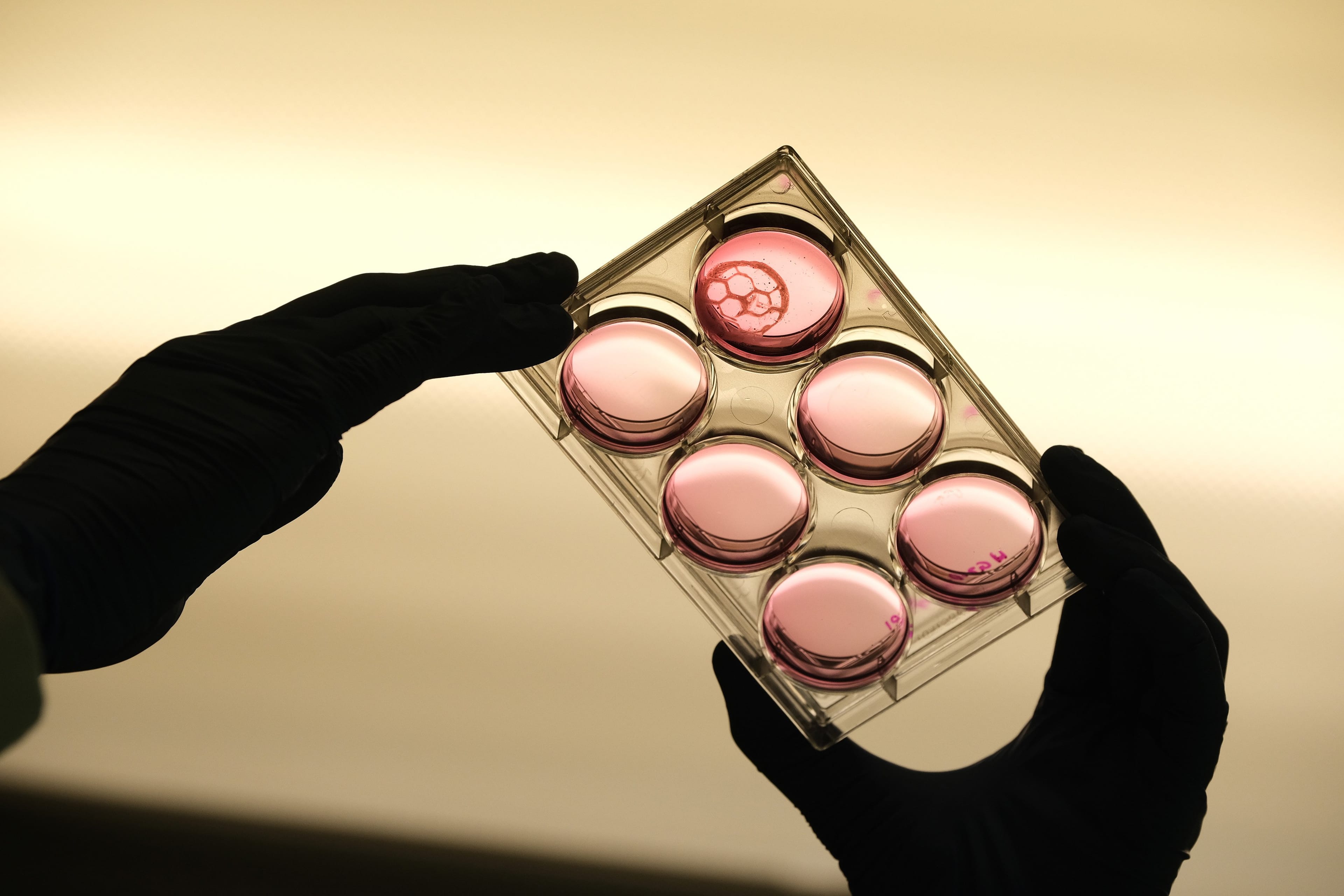 Bioprinted human liver tissue for diabetes-in-a-dish. (Frank Michael Photography, Windsor)