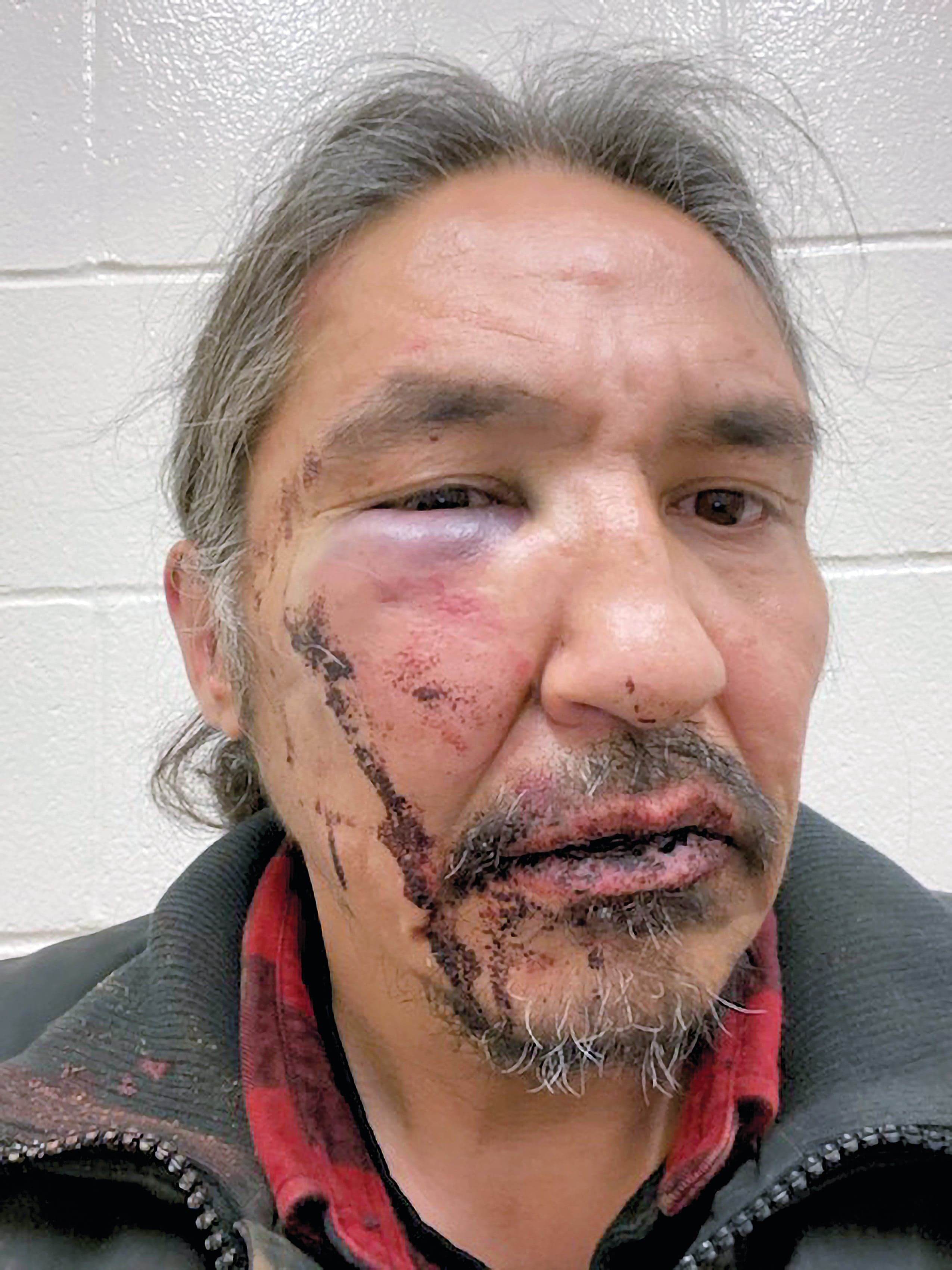 Chief Adam in his doctor’s office after his March 10 arrest (Courtesy of Ben Parson)