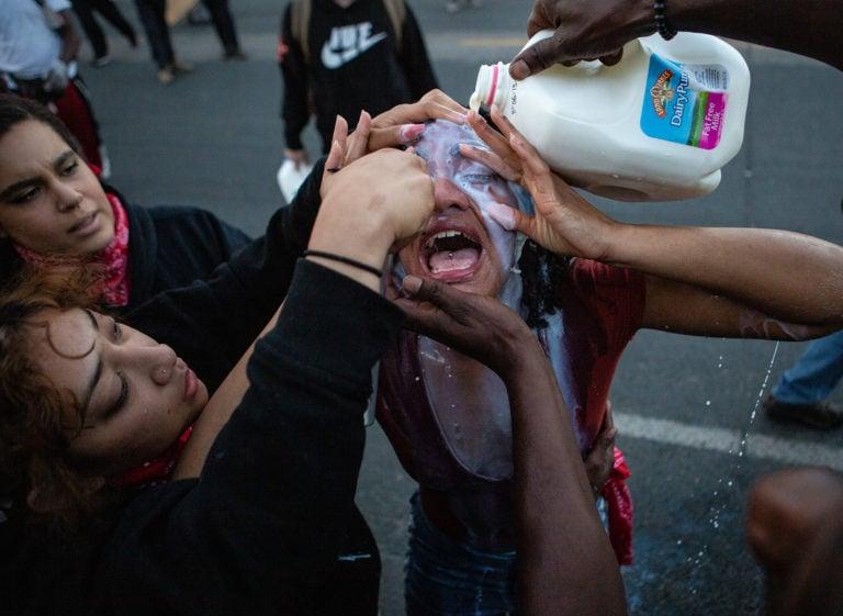 A woman gets help rinsing her eyes with milk after being targeted with pepper spray (Jason Armond / Los Angeles Times/Getty Images)