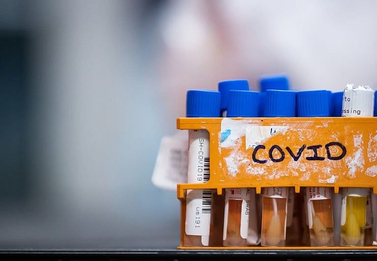 Specimens to be tested for COVID-19 in B.C. (Darryl Dyck/CP)